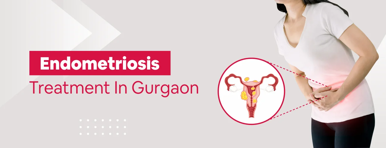 Endometriosis Treatment In Gurgaon 