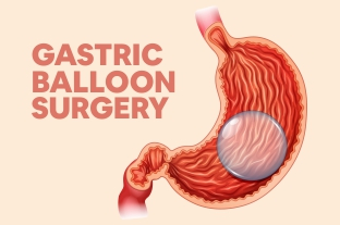 What is Gastric Balloon Treatment