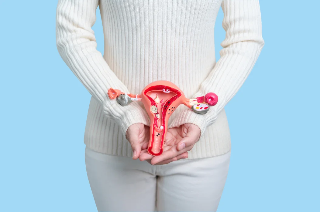 What are uterine fibroids