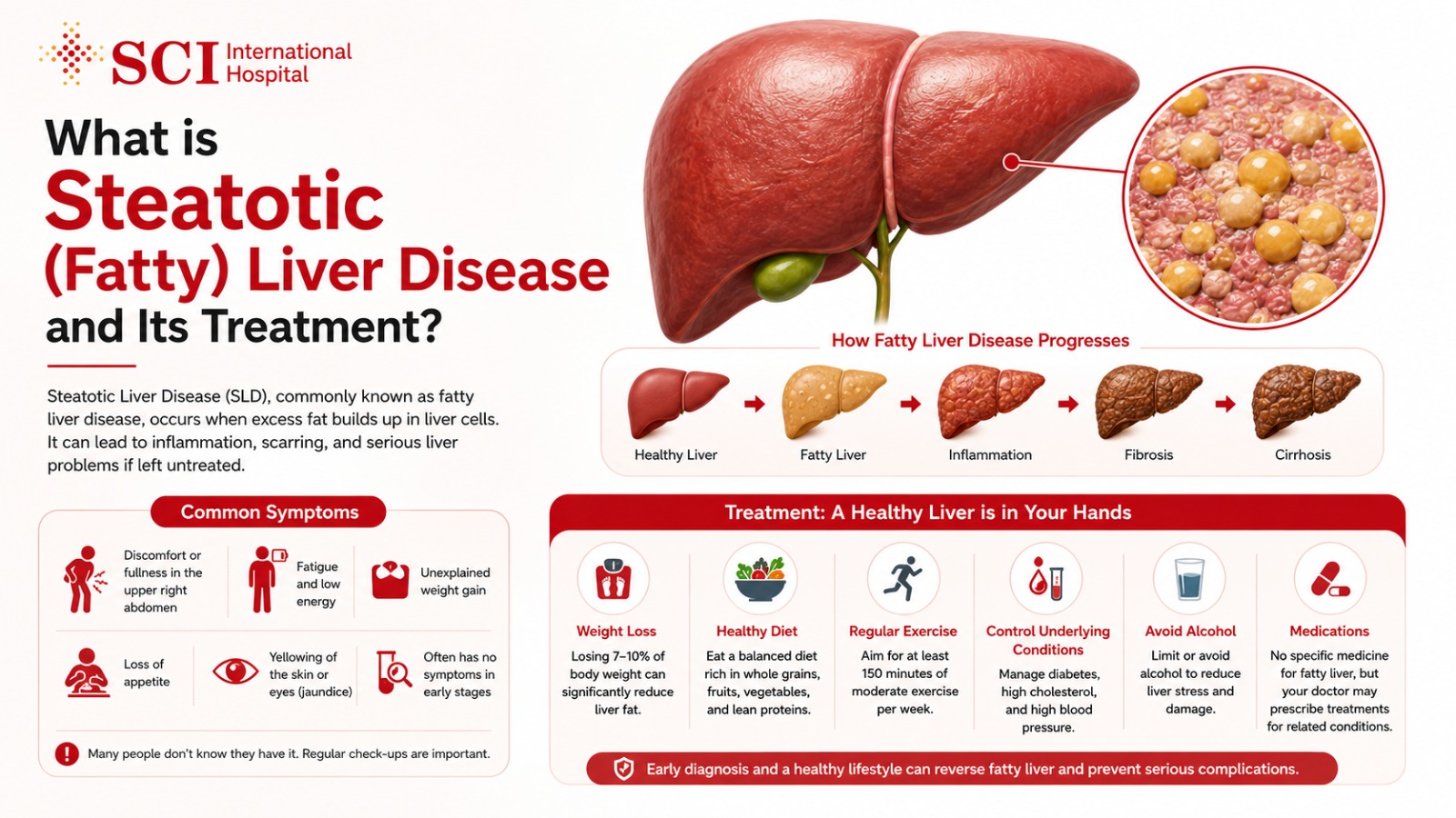 What is Steatotic (Fatty) Liver Disease and its treatment