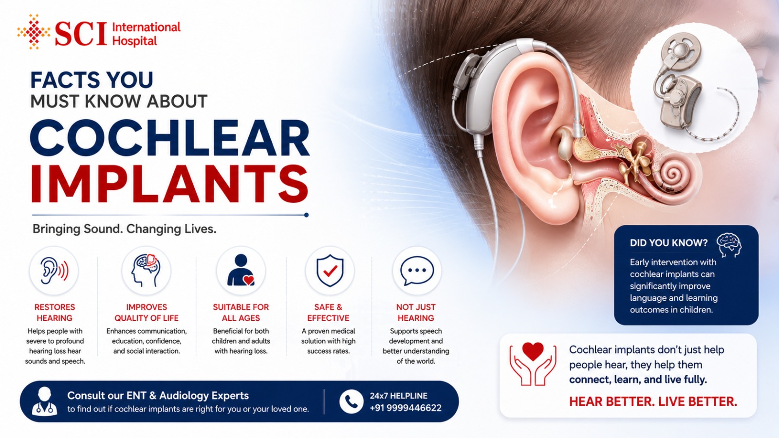 Facts you Must Know about Cochlear Implants