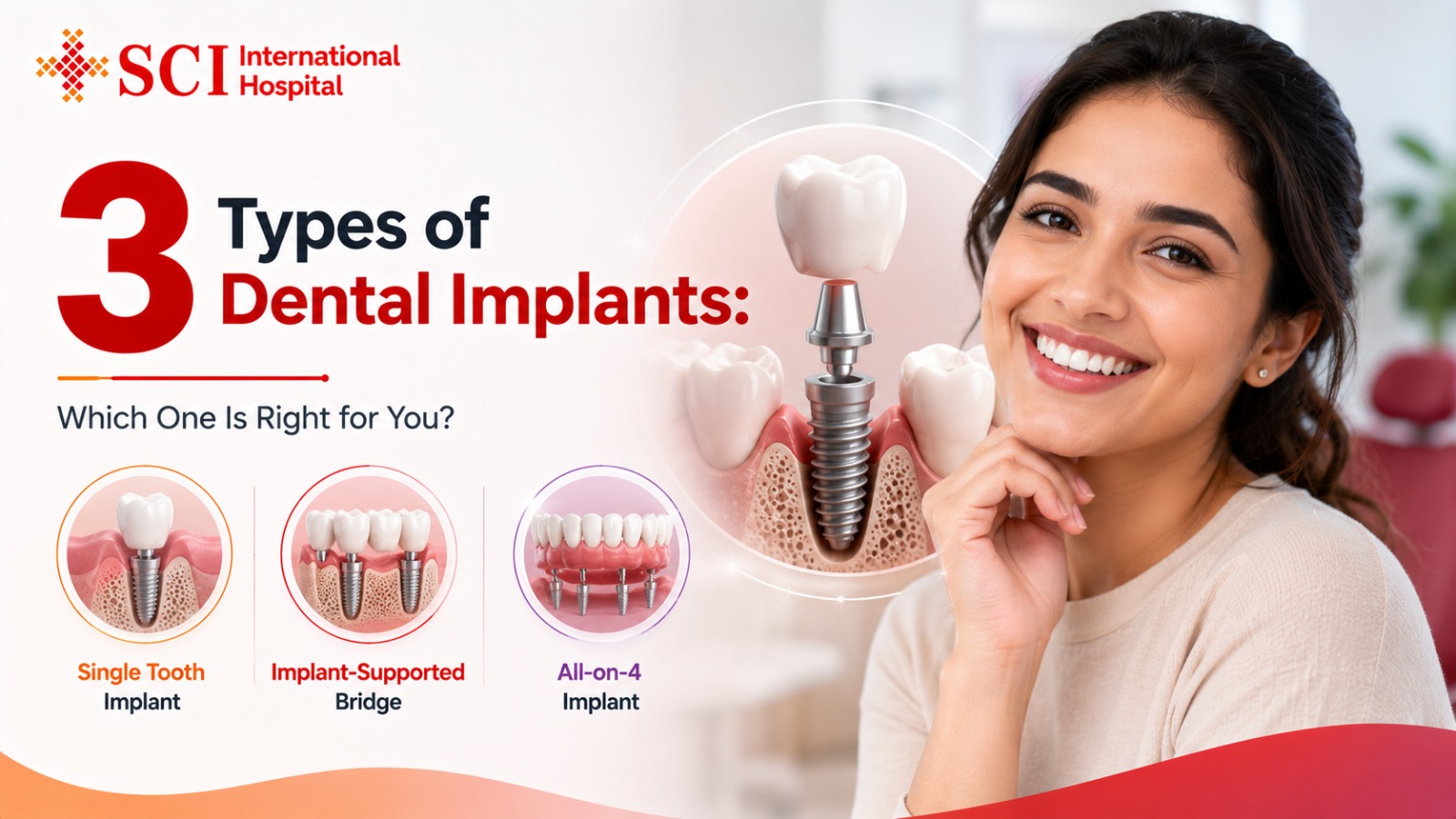 3 Types of Dental Implants: Which One Is Right for You?
