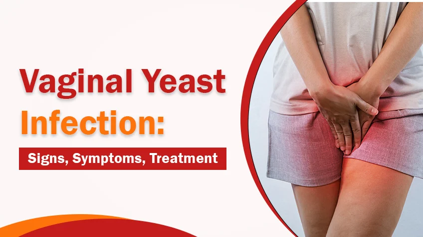Vaginal Yeast Infection: Signs, Symptoms, Treatment