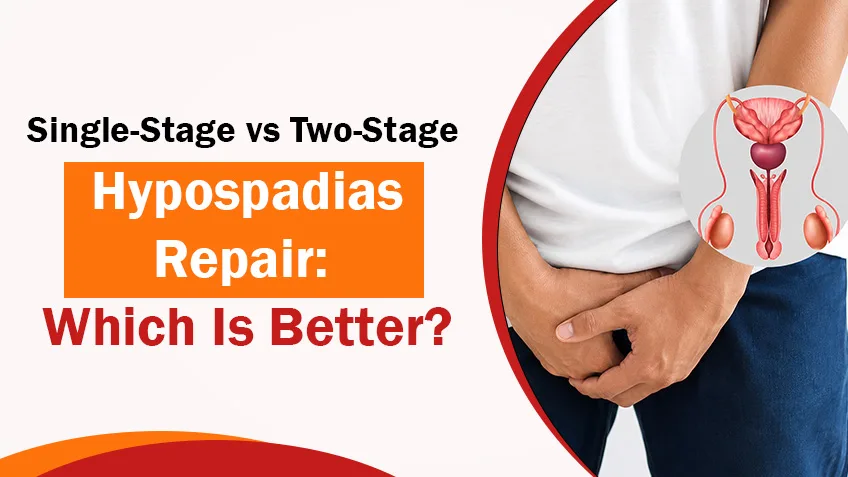 Single-Stage vs Two-Stage Hypospadias Repair: Which Is Better?