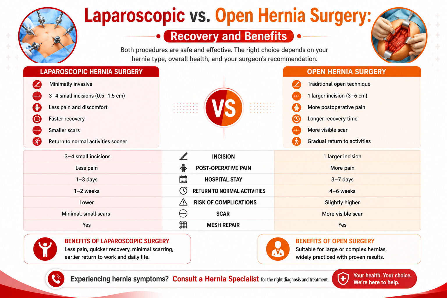 Laparoscopic vs. Open Hernia Surgery: Recovery and Benefits